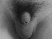 Micro penis photo